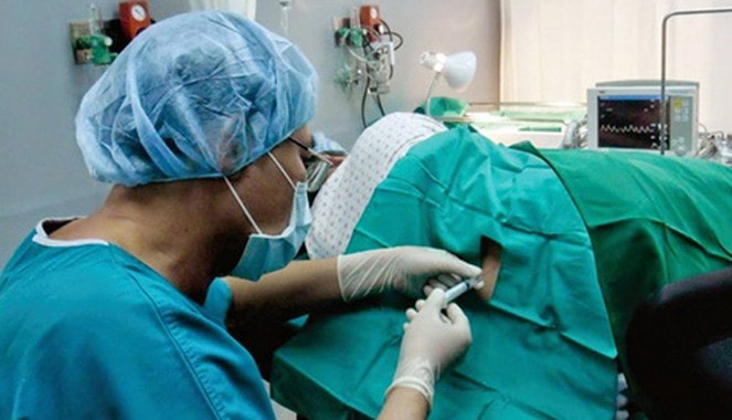 Gây tê tủy sống vẫn tiềm ẩn nhiều rủi ro nguy hiểm