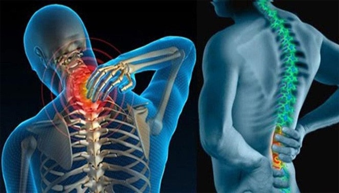 Ảnh minh họa Bệnh viêm khớp cột sống