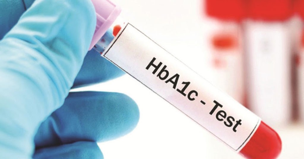 Xét nghiệm HbA1C - chẩn đoán bệnh đái tháo đường