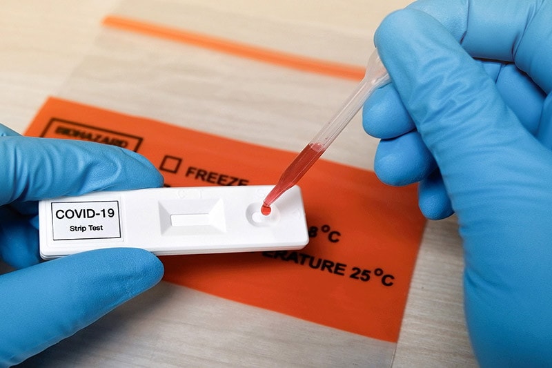 Yêu cầu doanh nghiệp báo cáo khẩn khả năng cung ứng, giá test xét nghiệm và chịu trách nhiệm về tính chính xác