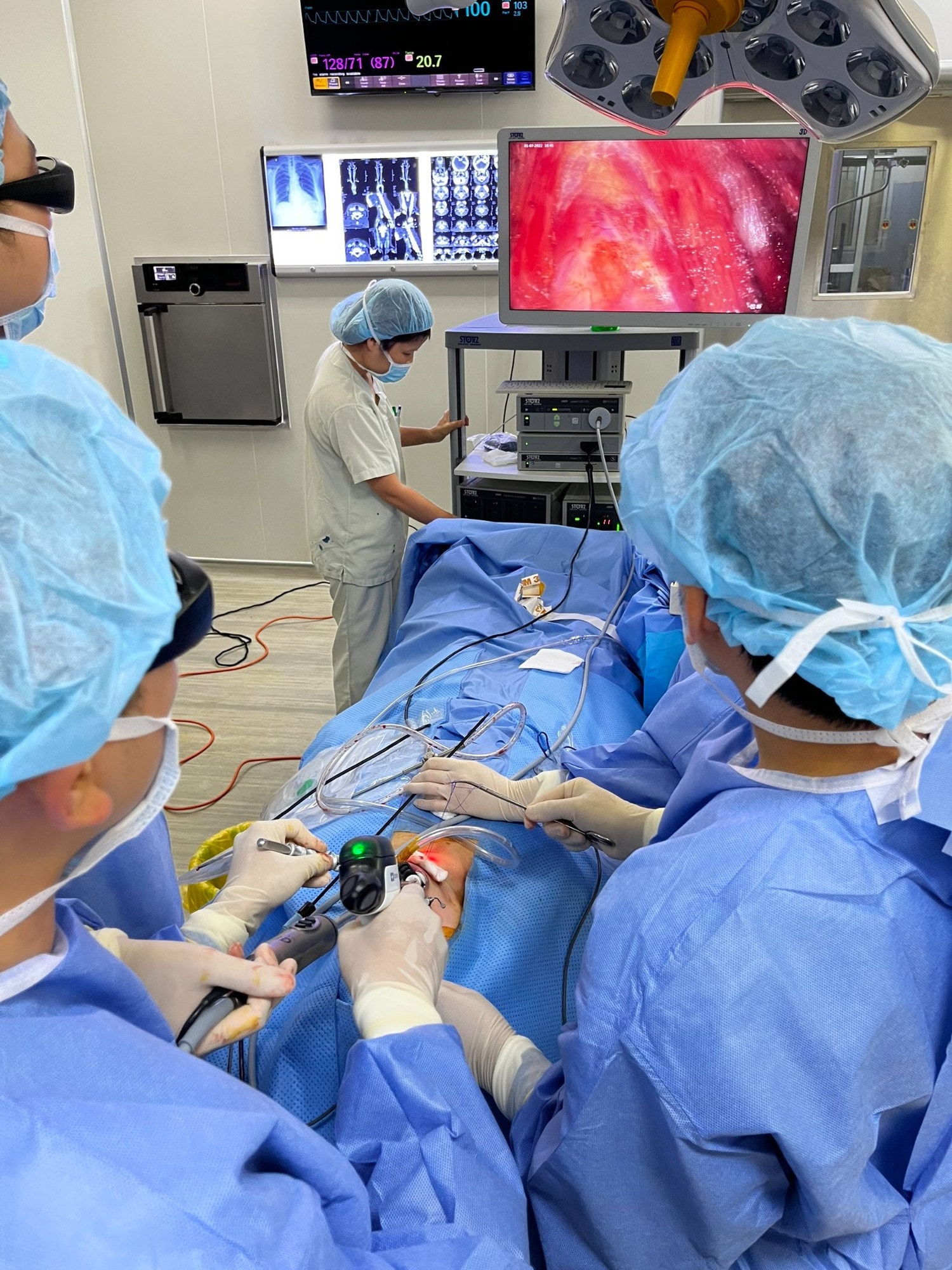 Bệnh viện E triển khai phẫu thuật nội soi tuyến giáp qua đường miệng -0