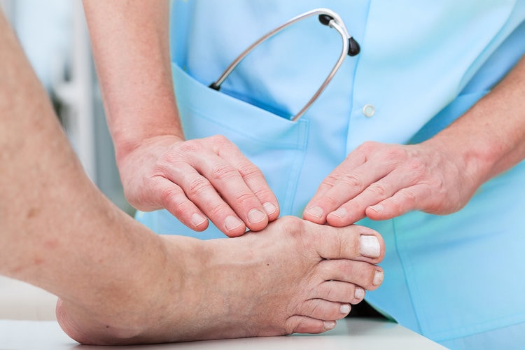 Những sai lầm thường gặp ở người bệnh gout -0