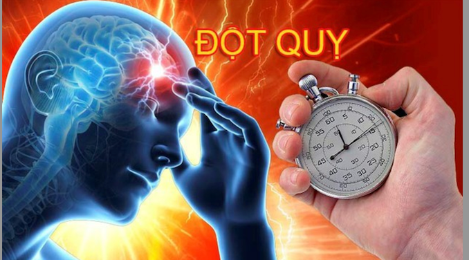 7 điều bạn có thể làm để ngăn ngừa đột quỵ -0