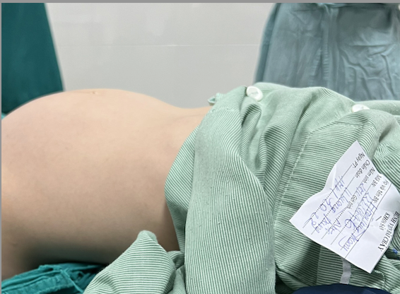 Cảnh giác khi trẻ bất ngờ đau bụng dữ dội, co thắt bụng dưới -0