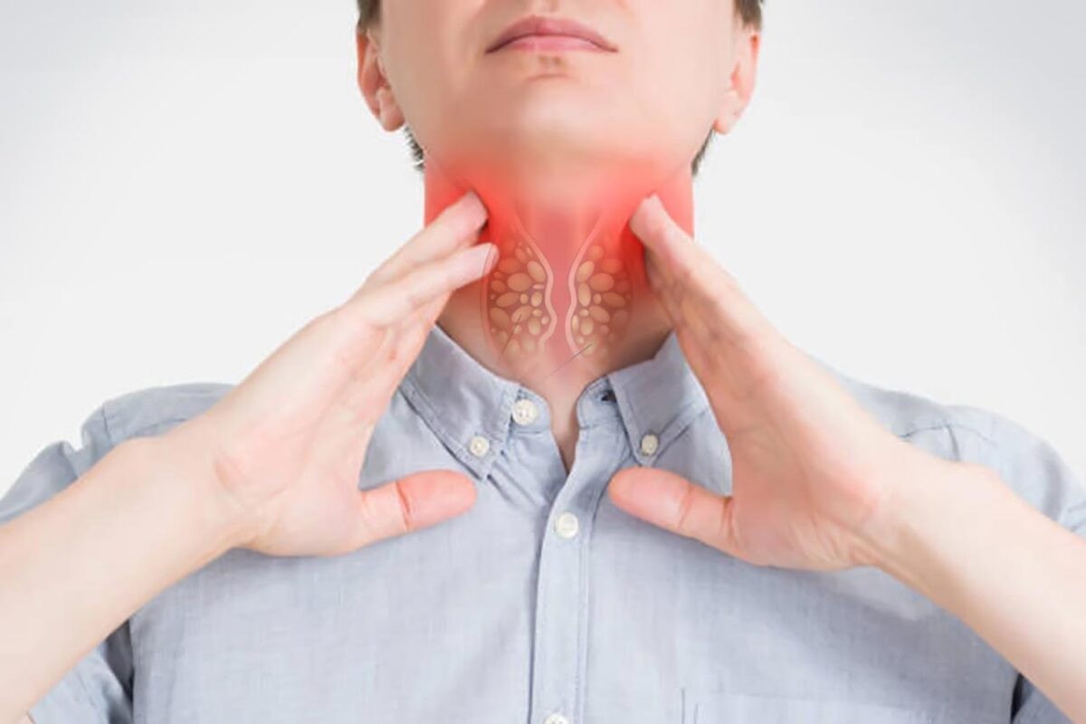 Những yếu tố làm tăng nguy cơ mắc ung thư thực quản -0
