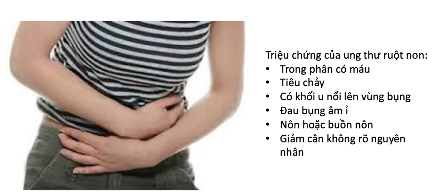 Ung thư ruột non: Triệu chứng và cách phòng ngừa -0