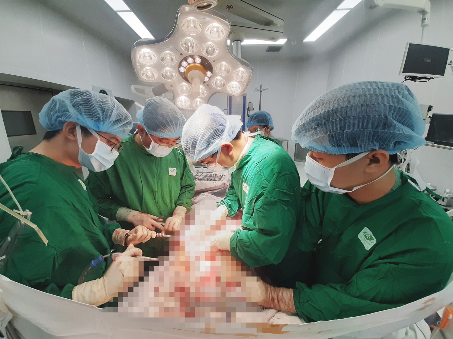 Bệnh viện Quân y 175 đã kích hoạt quy trình báo động đỏ (Code Red) để cấp cứu, phẫu thuật kịp thời, cứu sống có 5 vết thương vùng thành ngực