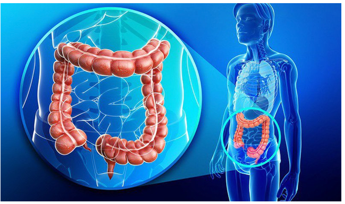 Ung thư đại trực tràng đang có xu hướng gia tăng -0