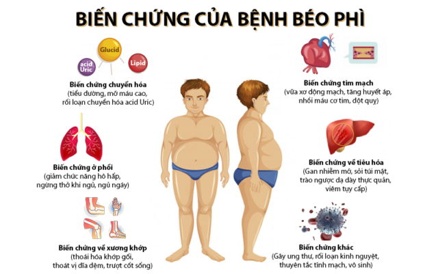 Vì sao béo phì làm giảm tuổi thọ? -0