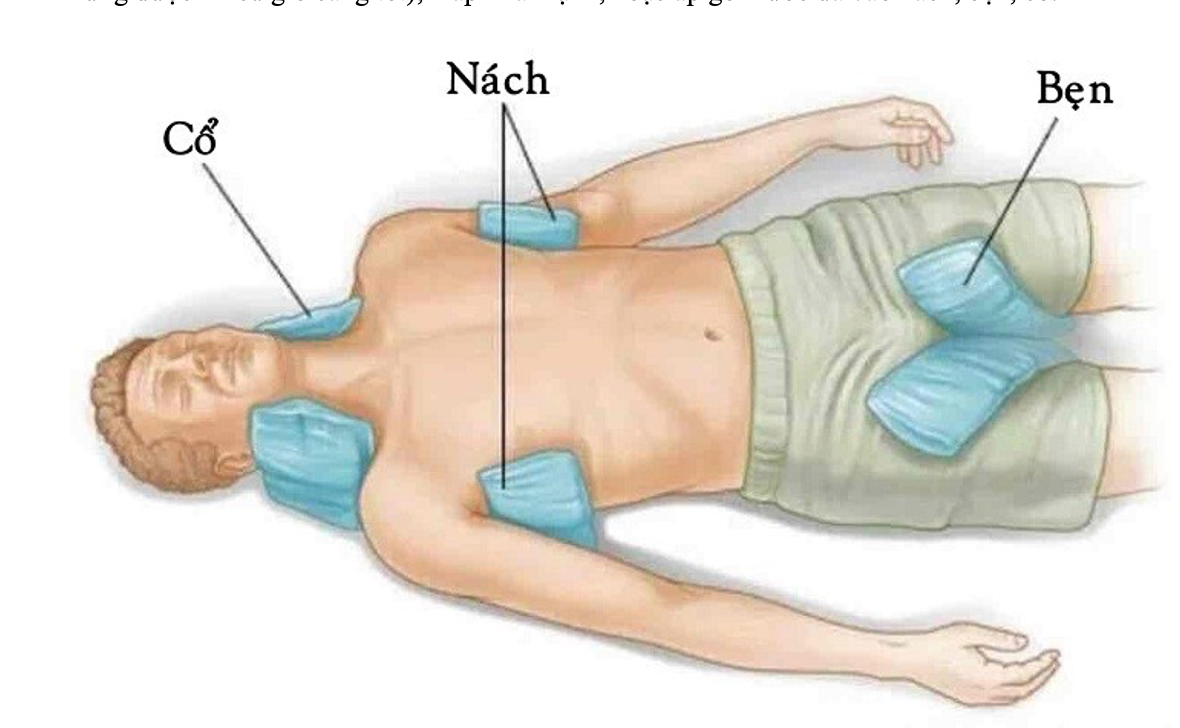 Biểu hiện của say nắng, say nóng và cách xử trí -0