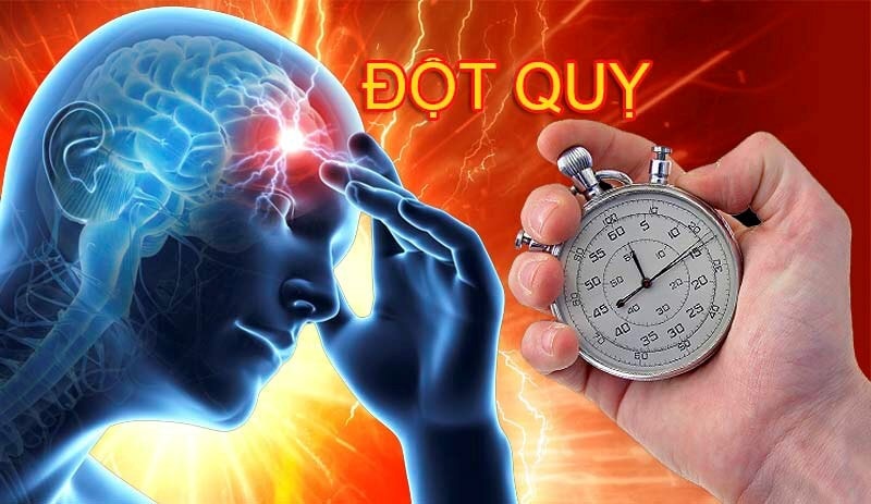 Cảnh báo: Gia tăng bệnh nhân tai biến, đột quỵ não do trời nắng nóng -0