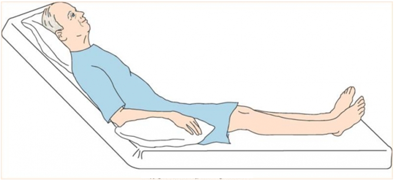 Dấu hiệu nhận biết bệnh nhồi máu cơ tim -0