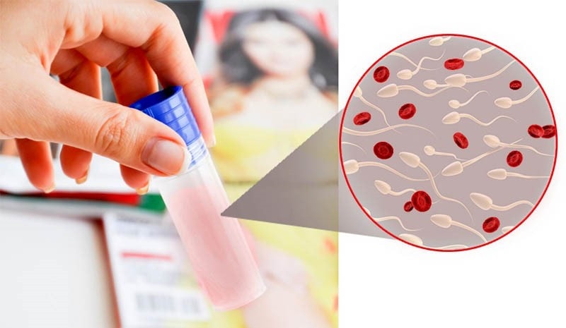 Tiểu đau, táo bón là một trong các triệu chứng của ung thư đường tiết niệu -0
