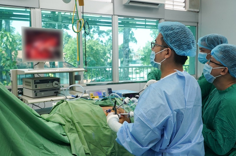 Lần đầu tiên tại Việt Nam, dùng phẫu thuật nội soi điều trị thành công cho bệnh nhân ung thư thận có chồi bướu trong tĩnh mạch chủ. (Ảnh: Bệnh viện Chợ Rẫy)