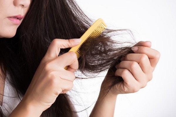 Thủ phạm “ẩn mình” khiến tóc bạn rụng từng mảng -0