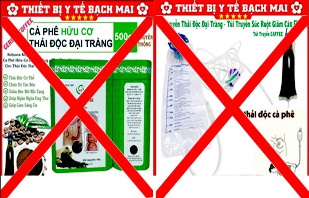 Thải độc bằng phương pháp thụt cà phê gây vỡ trực tràng: Bác sĩ chỉ cách thực hiện an toàn! -0