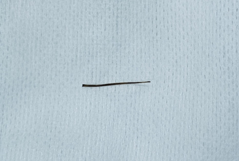 Bác sĩ cảnh báo nguy cơ thủng đường tiêu hóa do dị vật -0