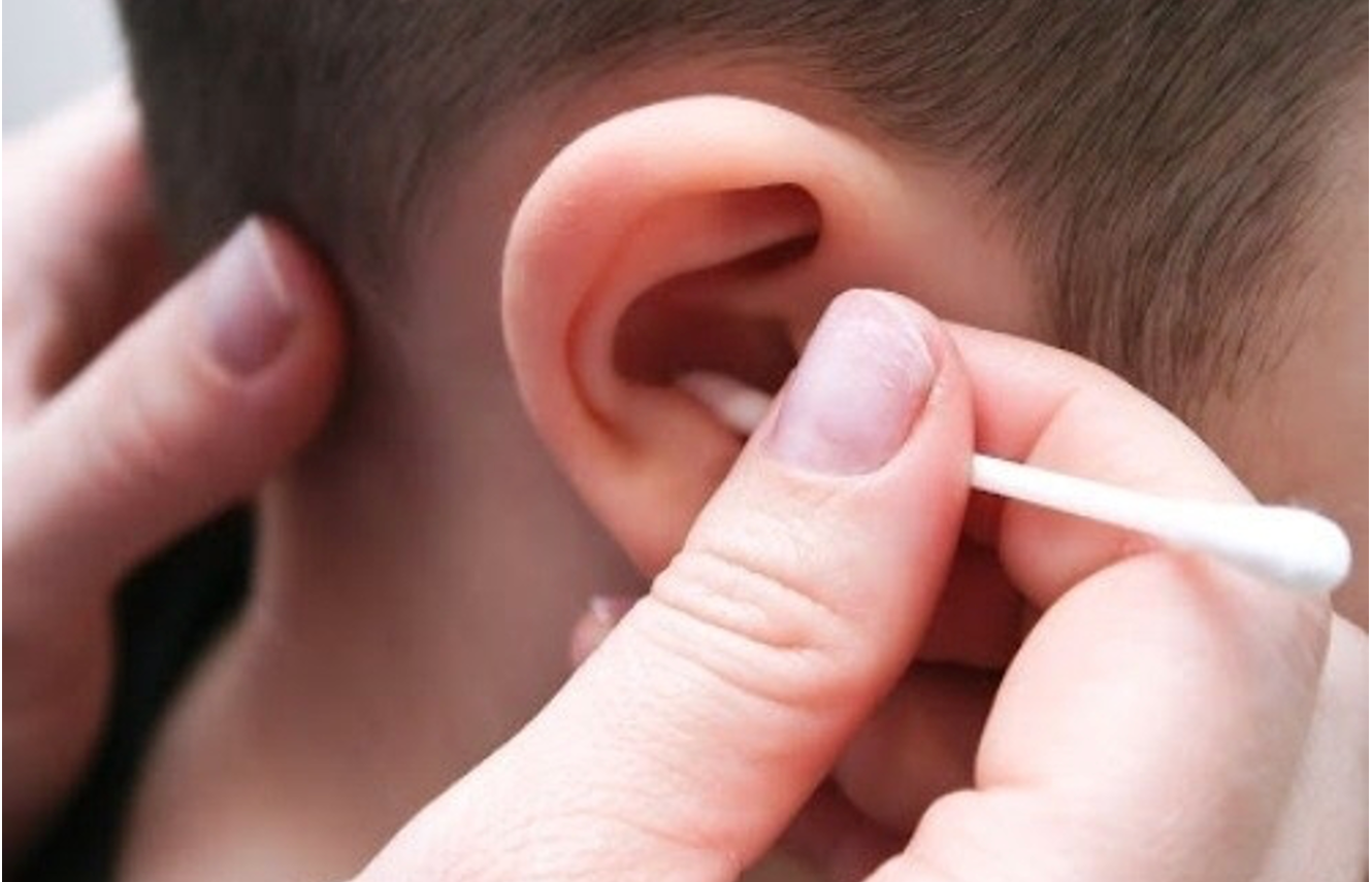 Cảnh báo nguy hiểm từ dụng cụ ngoáy tai: thủng màng nhĩ, giảm thính lực -0