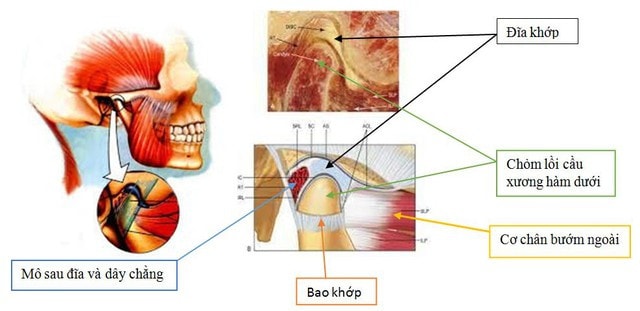 Bác sĩ cảnh báo một số thói quen dẫn đến rối loạn khớp thái dương hàm -0