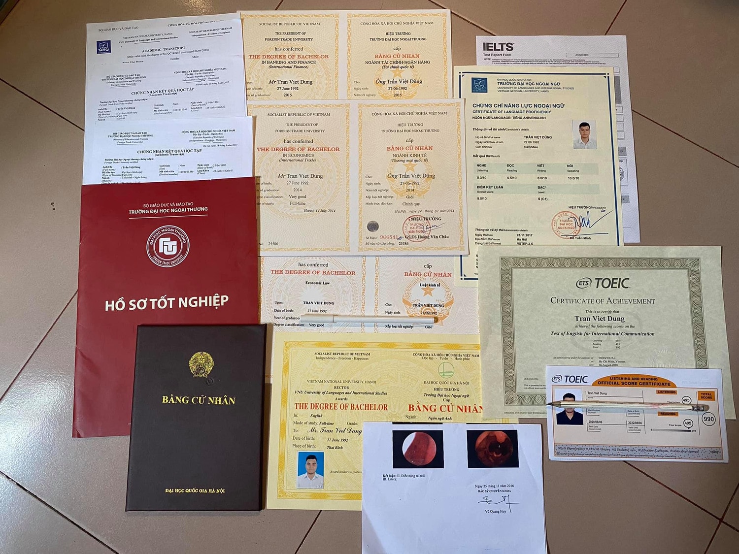 Chàng trai mất thính lực lấy 4 bằng đại học trong 6,5 năm, đạt IELTS 8.0, TOEIC 990 -0