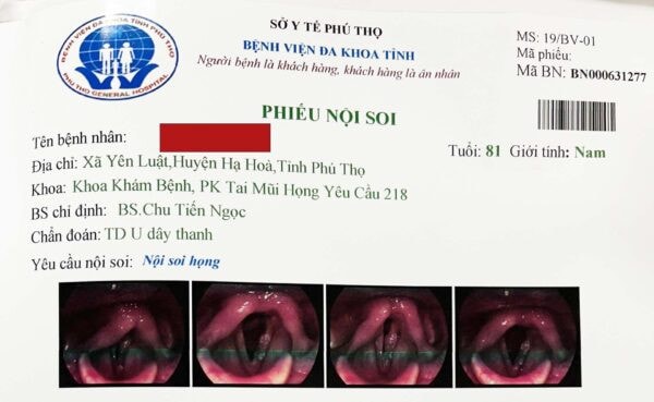 Chủ quan nghĩ mình bị ho, cụ ông bất ngờ bị ung thư vùng thanh quản -0