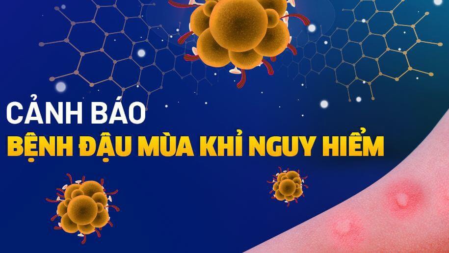 Phát hiện 2 trường hợp mắc bệnh Đậu mùa khỉ tại TP. Hồ Chí Minh và Bình Dương -0
