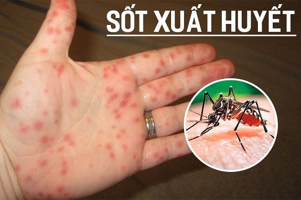 Hà Nội: Dịch sốt xuất huyết tăng mạnh, hơn 2400 ca mắc/tuần -0