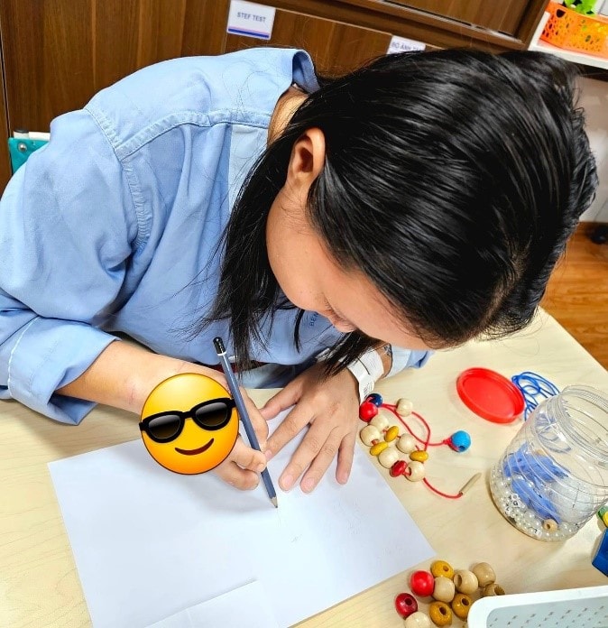 Bệnh viện Đại học Y Hà Nội phẫu thuật thành công cho bệnh nhân đứt hoàn toàn bàn tay phải -0
