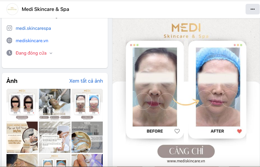 TP. Hồ Chí Minh: Medi Skin Care & Spa chưa có giấy phép hoạt động khám chữa bệnh