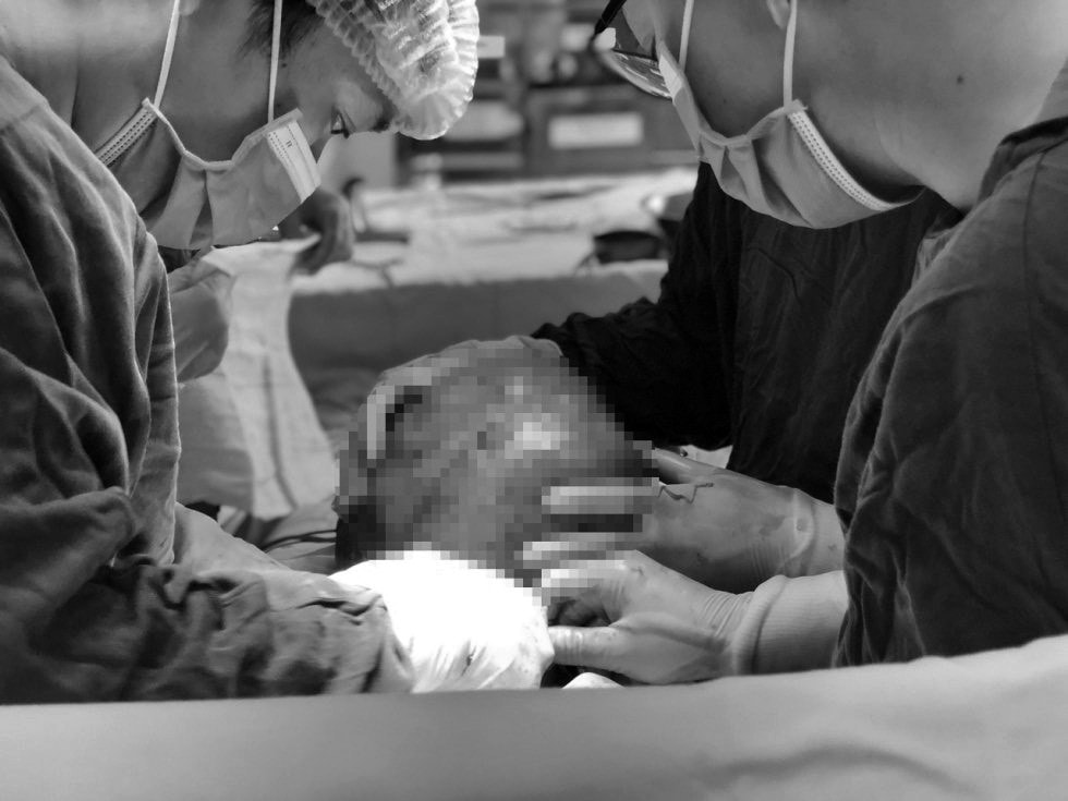 Tưởng béo bụng, người phụ nữ mang khối u “khủng” nặng 6 cân -0