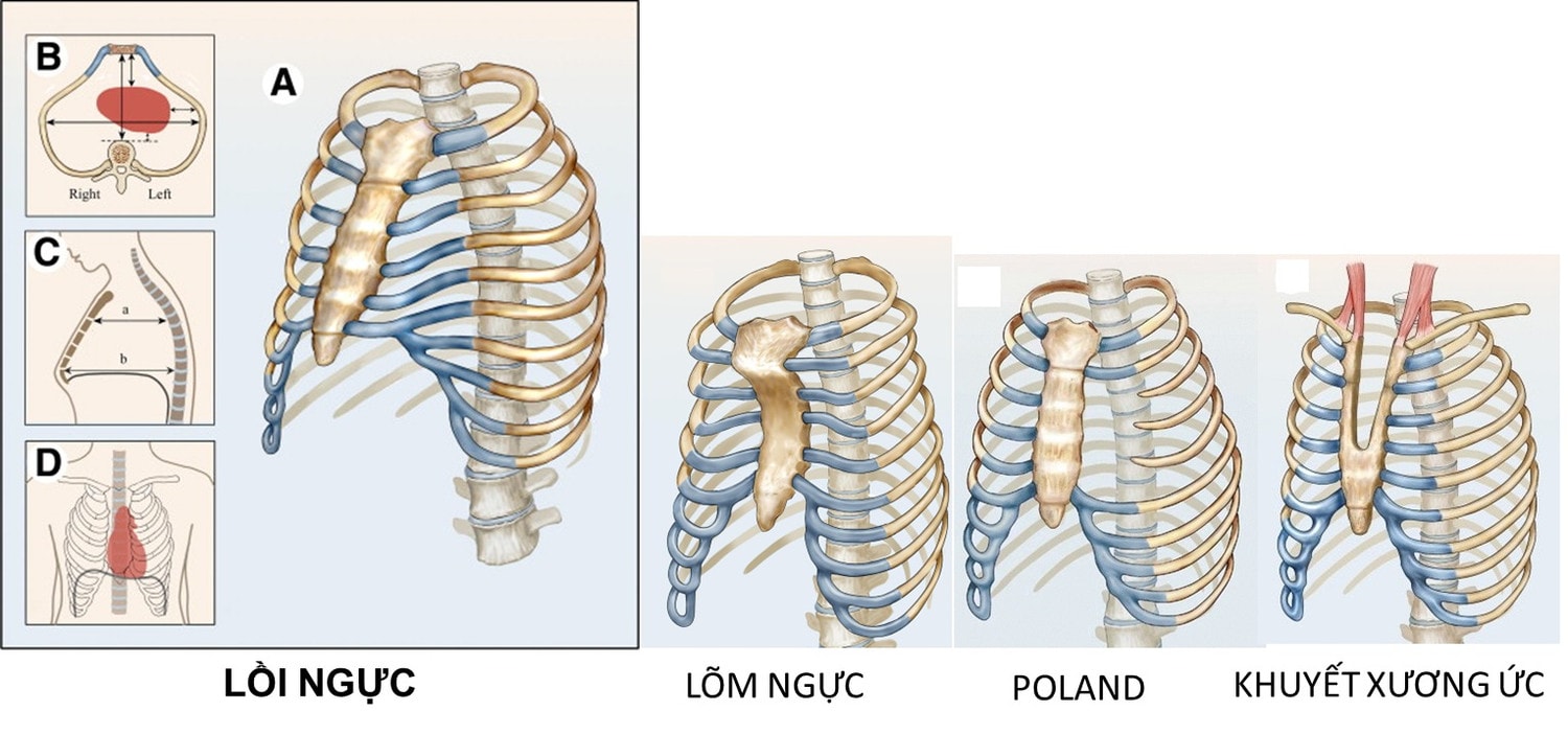 ngực-ức-gà-1-compressed.jpg -0