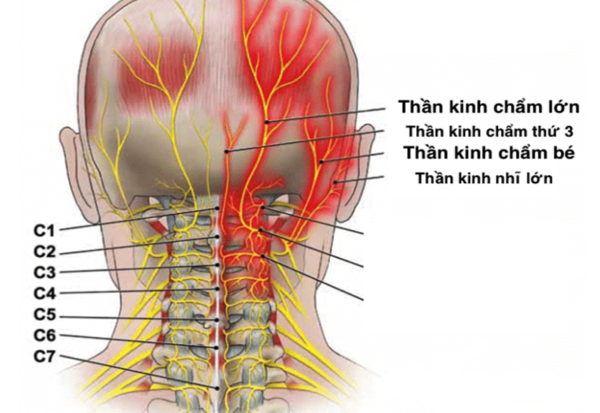 dau-day-than-kinh-cham-1-600x413.png -0