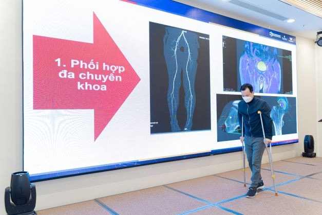 Bác sĩ và kỹ sư Việt Nam thiết kế xương nhân tạo mổ cứu bệnh nhân ung thư xương hiếm gặp -0