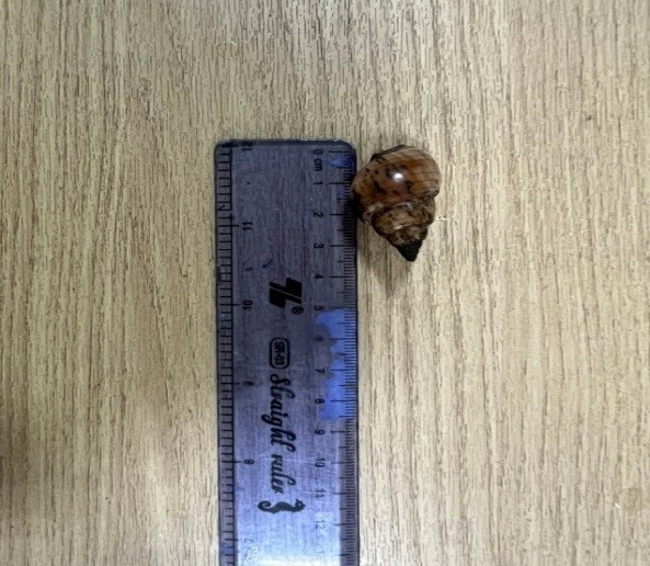 Ăn ốc bùn bóng, người đàn ông ngộ độc nặng rơi vào hôn mê -0