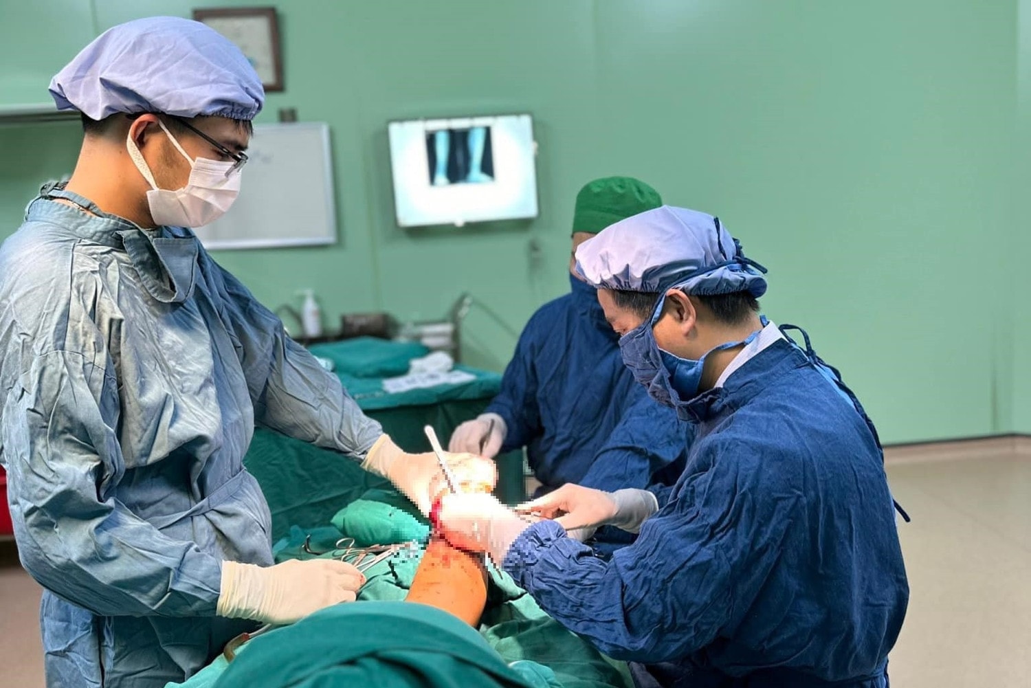 Phó Giám đốc BV đa khoa Ba Vì: Chỉ số khám bệnh, điều trị nội trú tăng 150% sau triển khai mô hình Bệnh viện chị - em -0