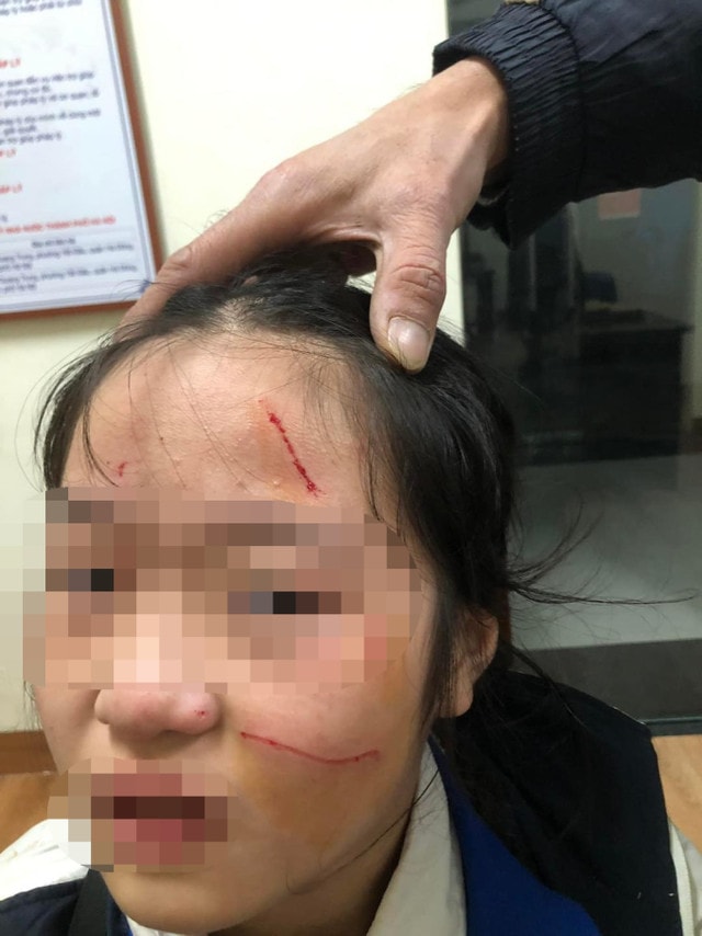  Yêu cầu nhà trường nghiêm túc rút kinh nghiệm trong quản lý học sinh -0