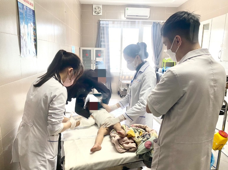 Bỏng nặng do bất cẩn của người lớn, 2 bệnh nhi nhập viện -0