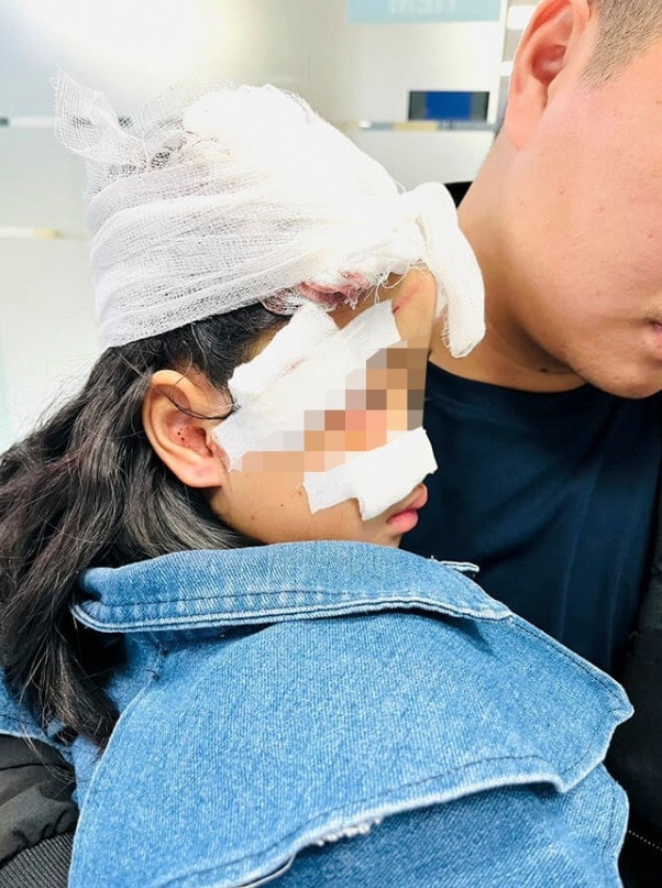 Gần 90 trường hợp trẻ bị vật nuôi tấn công nguy hiểm trong dịp Tết, bác sĩ cảnh báo -0