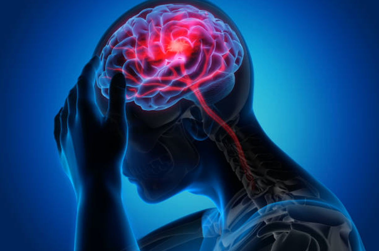 6 điều cần làm và 3 điều nên tránh đối với bệnh nhân đột quỵ -0