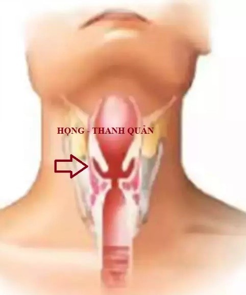Giữ giọng luôn trong trẻo trong mùa hè -0