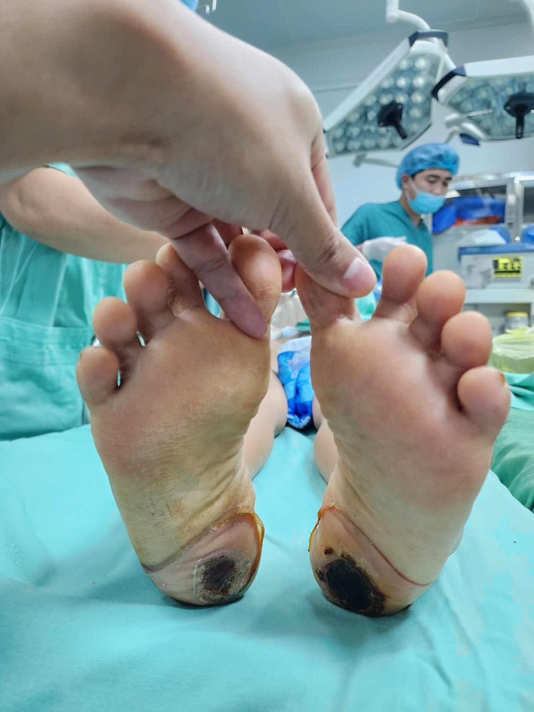 Người phụ nữ suýt liệt vĩnh viễn do chữa đau cột sống bằng phương pháp dân gian -0
