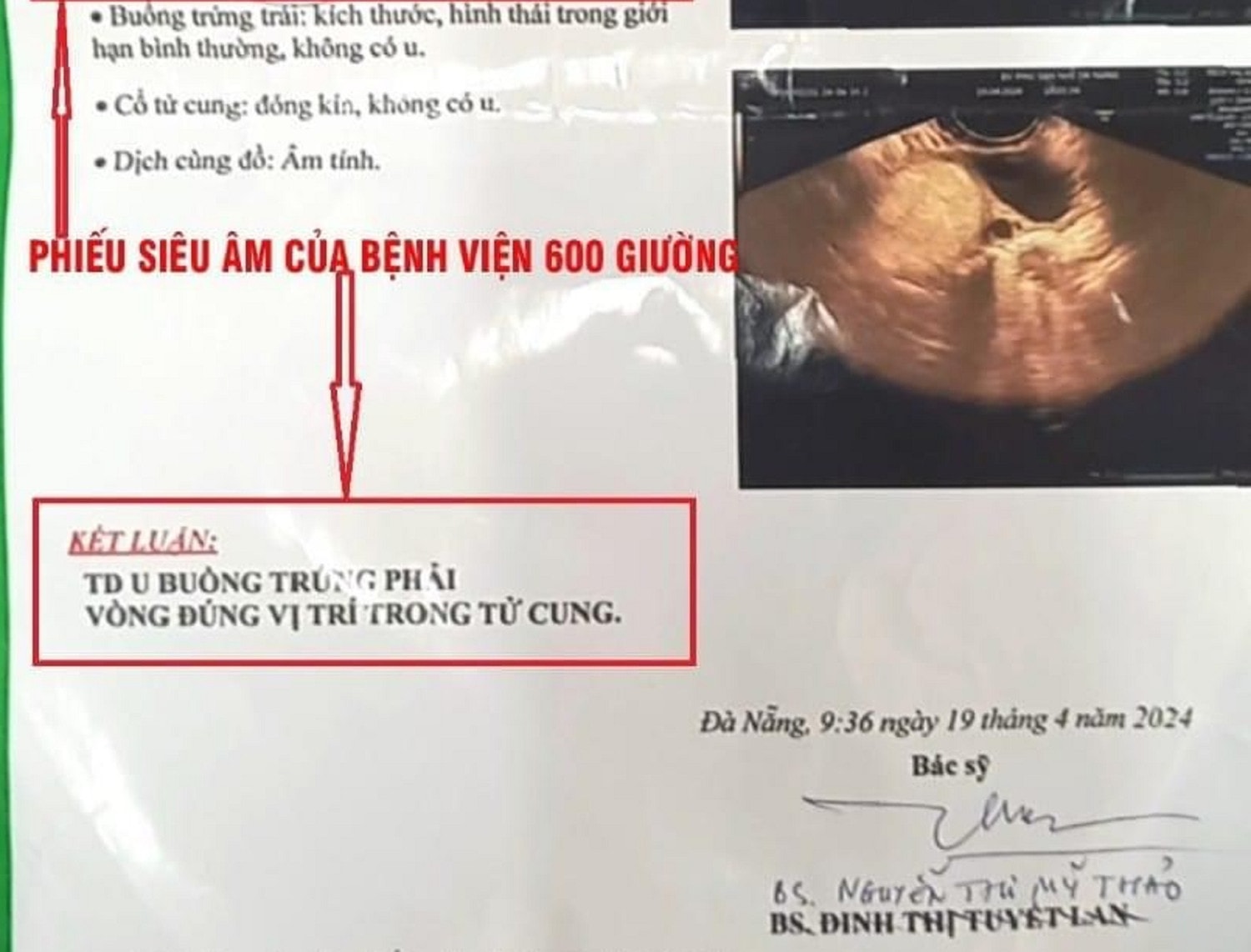 Vụ “chẩn đoán u buồng trứng phải, bệnh viện mổ bên trái”: Lập hội đồng kỷ luật, xử nghiêm các vi phạm -0