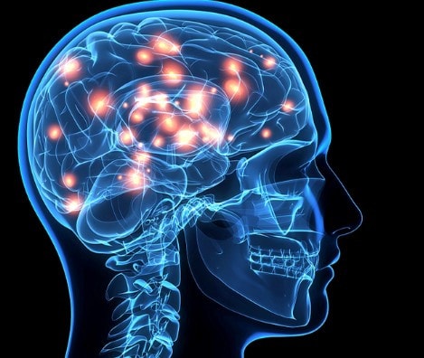 Người bị bệnh u màng não nguy hiểm như thế nào?