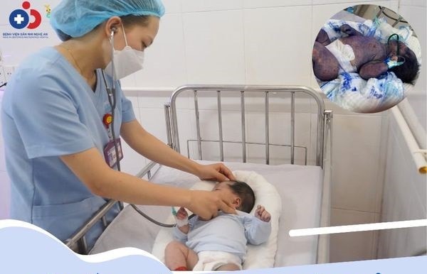 Trẻ sơ sinh nguy kịch do thuỷ đậu toàn thân, bác sĩ cảnh báo -0