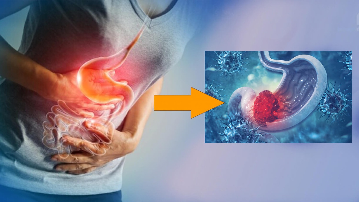 Tỷ lệ ung thư dạ dày ngày càng trẻ hoá, bác sĩ cảnh báo -0