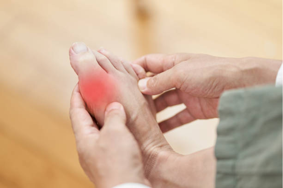 Bác sĩ hướng dẫn chế độ dinh dưỡng giúp kiểm soát bệnh gout -0