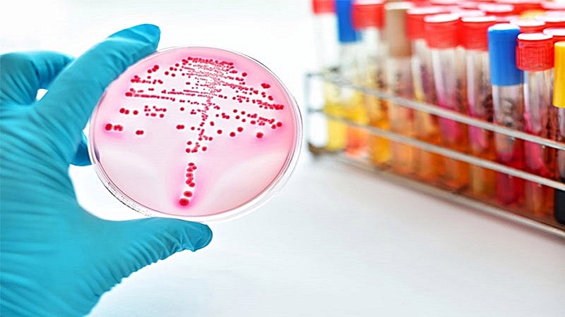 Các ca bệnh nghi bạch hầu cần được hội chẩn tuyến trên -0