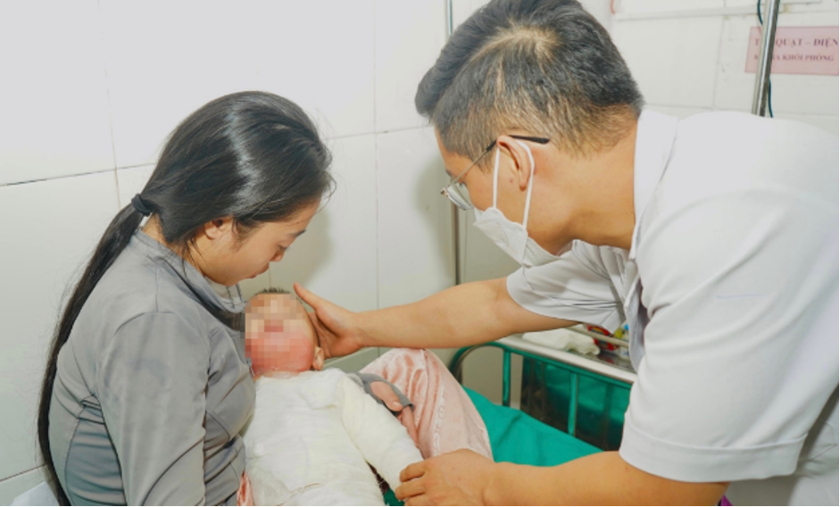 Bác sĩ hướng dẫn cha mẹ cách sơ cứu ban đầu khi trẻ bị bỏng -0