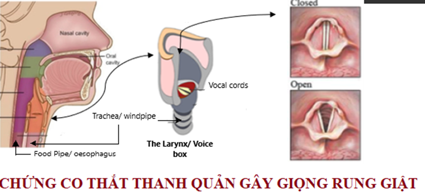 Đối phó ra sao với khàn tiếng? -0