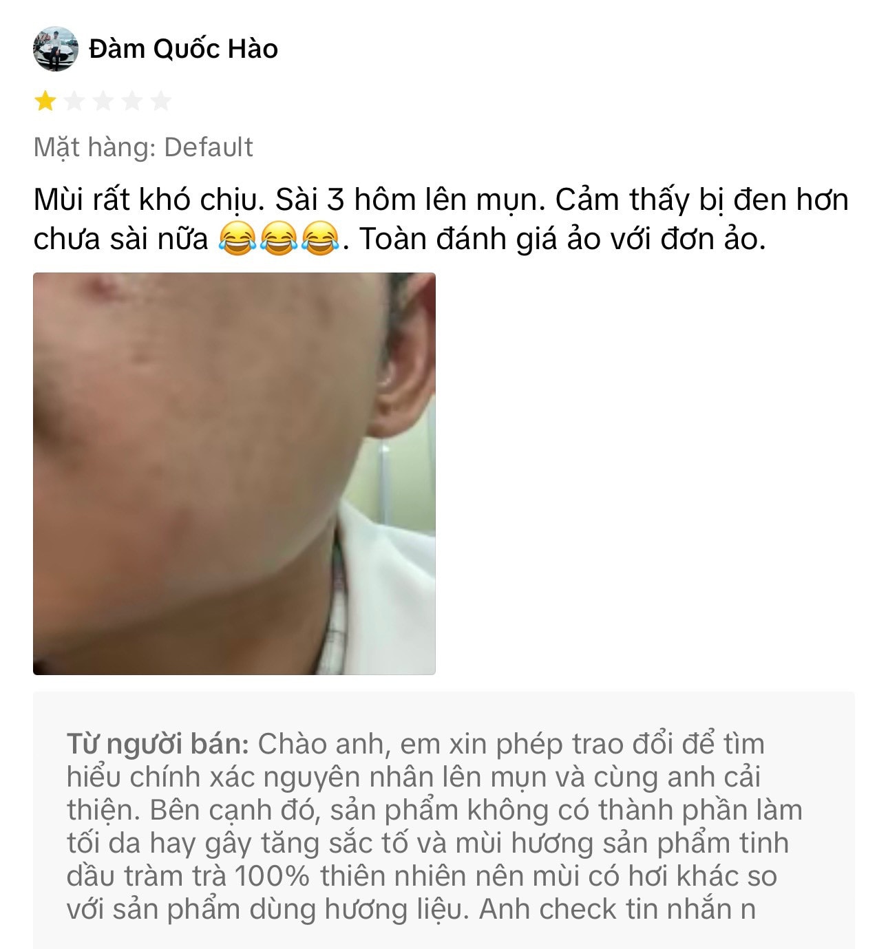 Mỹ phẩm nhãn hiệu “Simplicity”: Quảng cáo rầm rộ nhưng bị nhiều khách hàng đánh giá “1 sao” vì chất lượng -0